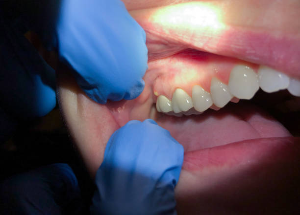 Best Walk-In Emergency Dentist in Loop, PA