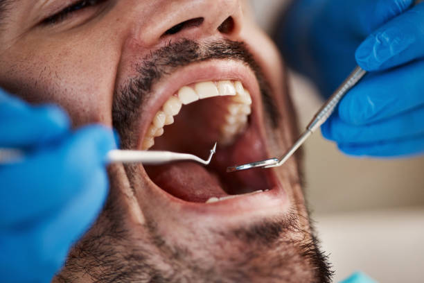 Best Emergency Broken Tooth Repair in Loop, PA